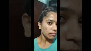 25 days complete tretinoin cream 0025 tretinoincream face tretinoin [upl. by Hirz393]