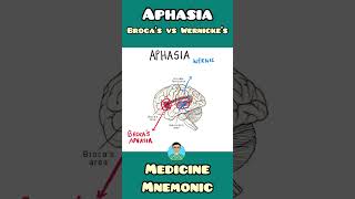 Brocas Aphasia VS Wernickes Aphasia  mnemonic  shorts [upl. by Esertal927]