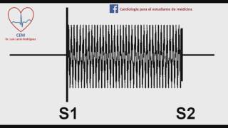 Soplo de la insuficiencia tricuspideamurmur of tricupsid regurgitation [upl. by Joacimah856]