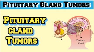 pituitary adenoma pathology [upl. by Balcke]