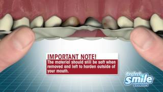 Perfect Smile Veneers Instructional  Getting Started [upl. by Aitekram]