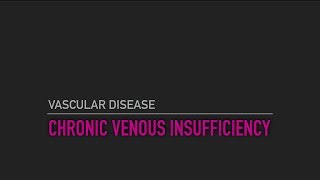 Chronic Venous Insufficiency [upl. by Towney]