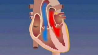 Transposition of the Great Arteries [upl. by Airednaxela]