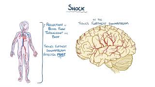 Osmosis  Ischaemic Stroke [upl. by Gensmer]