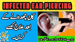 What is The treatment of Infected Ear Piercing  How to heal Infected Ear Piercing  Treatment [upl. by Dulce]