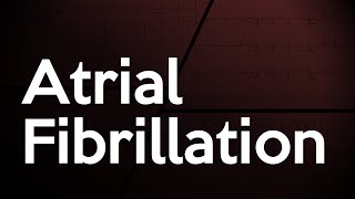 Atrial Fibrillation ECG [upl. by Eugeniusz]