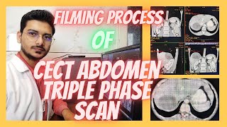 CT SCAN Abdomen Triple phase Filming process Triphasic abdominal Filming radiologytechnologist [upl. by Akselaw440]