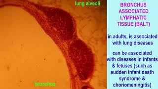 BronchusAssociated Lymphoid Tissue BALT [upl. by Bordie]