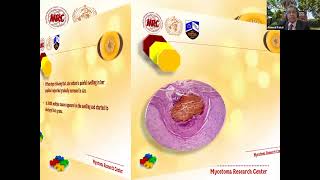 MycoClinics 4 Mycetoma and Candida and conduits [upl. by Islean438]