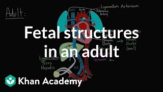 Fetal structures in an adult  Circulatory system physiology  NCLEXRN  Khan Academy [upl. by Nostrebor245]