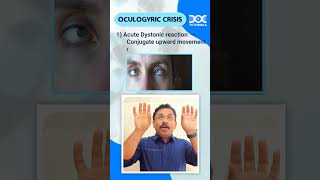 QuickLearningByte  OCULOGYRIC CRISIS  MEDICINE  DR RAHUL RAJEEV  DOCTUTORIALS [upl. by Woodman795]