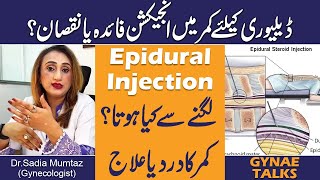 Epidural Injection In Labor  Delivery without pain Urdu Hindi  Kamar Men Injection [upl. by Davon994]