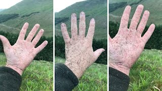 Giant Swarm Of Midges Stick To Hand In Scotland [upl. by Anilrac]