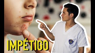 IMPÉTIGO Infección bacteriana en niños👶👦👧 [upl. by Nuajed]