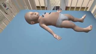 Bronchiolitis Diagnosis Simulation [upl. by Kcor]