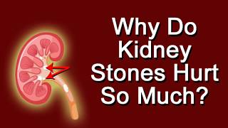 Why Do Kidney Stones Hurt So Much [upl. by Aldin238]