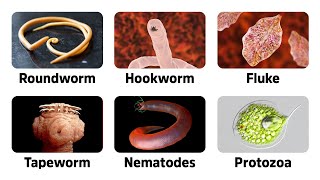 9 Warning Signs of Parasites [upl. by Adolphus]