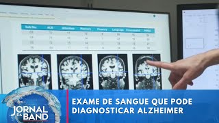 Cientistas desenvolvem exame de sangue que pode diagnosticar Alzheimer  Jornal da Band [upl. by Knut]