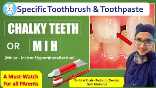 Chalky teeth Toothbrush amp Toothpaste for Chalky teeth or MIH [upl. by Geller148]