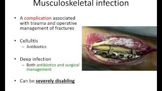 Orthopaedic trauma for med students 4 [upl. by Burton]