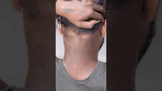 Remove Neck Darkness At Home In 5min  Neck Cleaning Tips  Dark Neck Remove Home Remedies shorts [upl. by Annaul648]