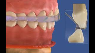 Les dents de la nuit  petite anthologie vampiresque Sarah CohenScali 🧛 [upl. by Swayder]