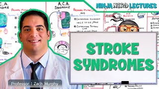 Stroke Syndromes MCA ACA ICA PCA Vertebrobasilar Artery Strokes  Pathophysiology [upl. by Hodess]