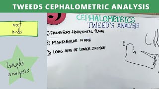 tweeds cephalometric analysis  orthodontics lecture notes [upl. by Chandra]