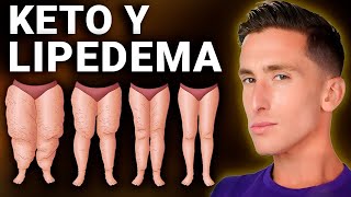 La dieta cetogénica tu mejor aliada ante el lipedema [upl. by Atte]