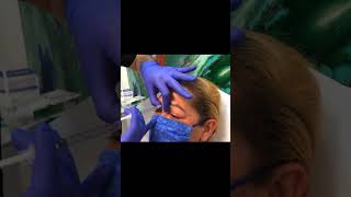 11 Lines Botox  Botox Injection For Glabella And Forehead shorts [upl. by Dareg]