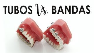 BANDAS Vs TUBOS  ¿QUÉ SON ¿CUÁL ES MEJOR [upl. by Marillin]