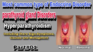 Hyperparathyroidism  Parathyroid gland Disorder By AbuBakar Med Plus [upl. by Marika]