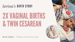 Larissas Birth Stories 2 Vaginal Births followed by Twin Cesarean [upl. by Teteak946]