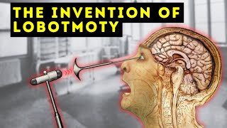 The Man Who Invented the Lobotomy  António Egas Moniz  Documentary [upl. by Huba]