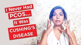 I Never Had PCOS It Was Cushings Disease  Cushings Syndrome cushing [upl. by Naraj426]