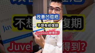 改善 凹痘疤 不想有 修復期 Juvelook 做得到⁉️ 吳仁欽皮膚科診所 喬雅露 頸紋 痘疤 膠原蛋白增生 舒顏萃 玻尿酸 淚溝 細紋 毛孔粗大 皮下剝離術 [upl. by Chadd]