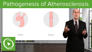 Pathogenesis of Atherosclerosis – Vascular Medicine  Lecturio [upl. by Salbu]