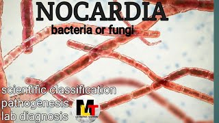 Nocardia ।। IntroductionScientific Classification Pathogenesis Laboratory Diagnosis of Nocardia [upl. by Kippie]