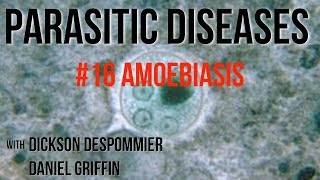 Parasitic Diseases Lectures 16 Amoebiasis [upl. by Yblehs443]