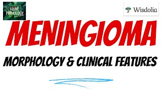 MENINGIOMA  Part 2  Histopathology  Clinical features Treatmentamp prognosis [upl. by Adli]