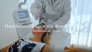 Hautbehandlungen mit dem CO2 Laser bei Dermacare Wien [upl. by Bosson823]