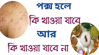 পক্স হলে কি খাওয়া যাবে  pox hole ki khabo [upl. by Lebbie]