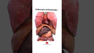 Endoscopic Ultrasound procedure  Short Animated Video [upl. by Bohner]