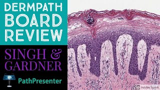 Dermpath Board Review 100 Classic Cases [upl. by Ahsiekan748]