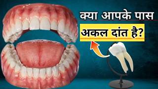 Types of Teeth  Wisdom Teeth  Dheeraj Kumar [upl. by Lyontine]