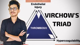 What is Virchows Triad Pathology Haemodynamics 60sec pathology medicalstudentshortsscience [upl. by Akinahc]