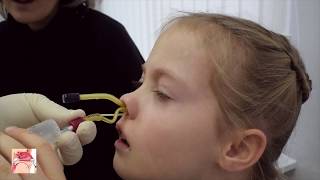 YAMIK procedure  a method for topical treatment of sinusitis [upl. by Ycats]