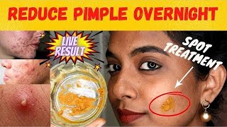 Teenage girls pimples remove at home 💯work  How to Use Turmeric for Acne and Pimples in Urdu Hindi [upl. by Alamaj642]