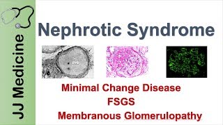 Nephrotic Syndrome  Clinical Presentation Causes and Treatment [upl. by Negris597]