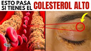 ¡ALERTA 10 SINTOMAS DE COLESTEROL ALTO Y NO TE DAS CUENTA [upl. by Kristina479]